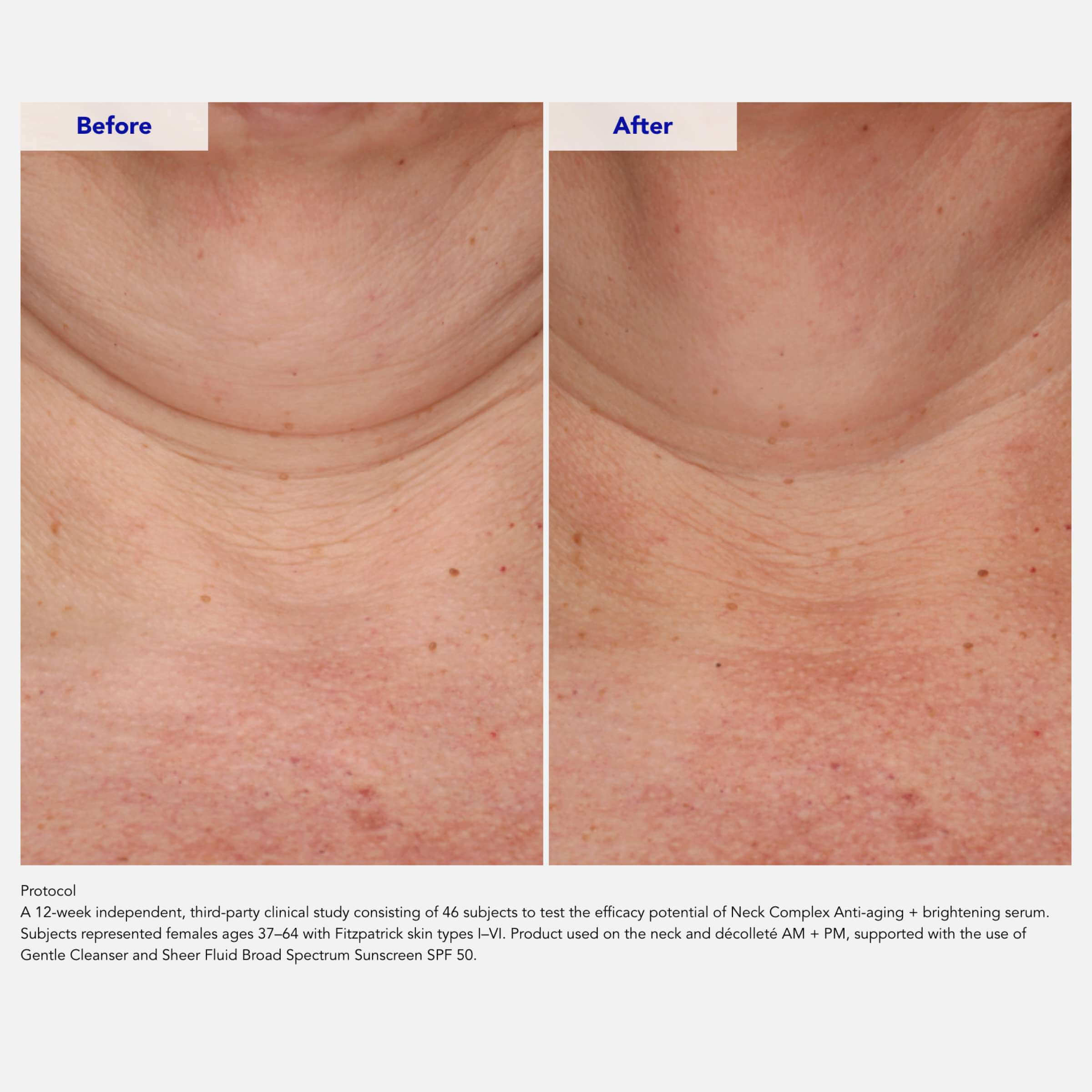 ZO Skin Health Neck Complex Anti-Aging + Brightening Serum - Eyes, Neck & Lips | MacroPanora