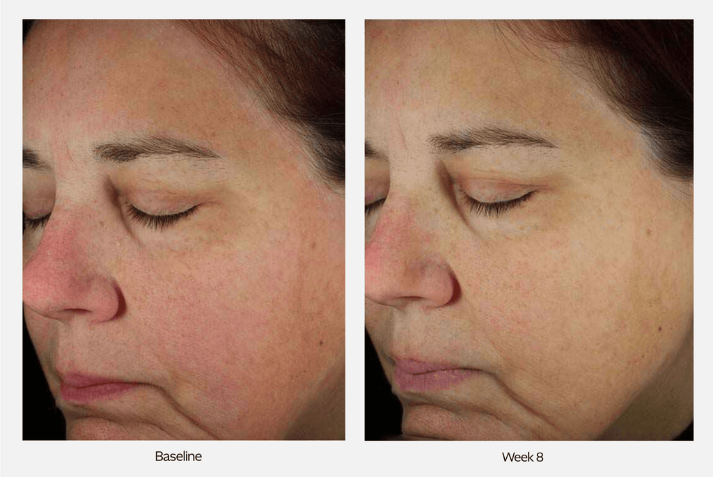 ZO Skin Health Next-Generation Daily Power Defense - Serums, Oils & Concentrates | MacroPanora