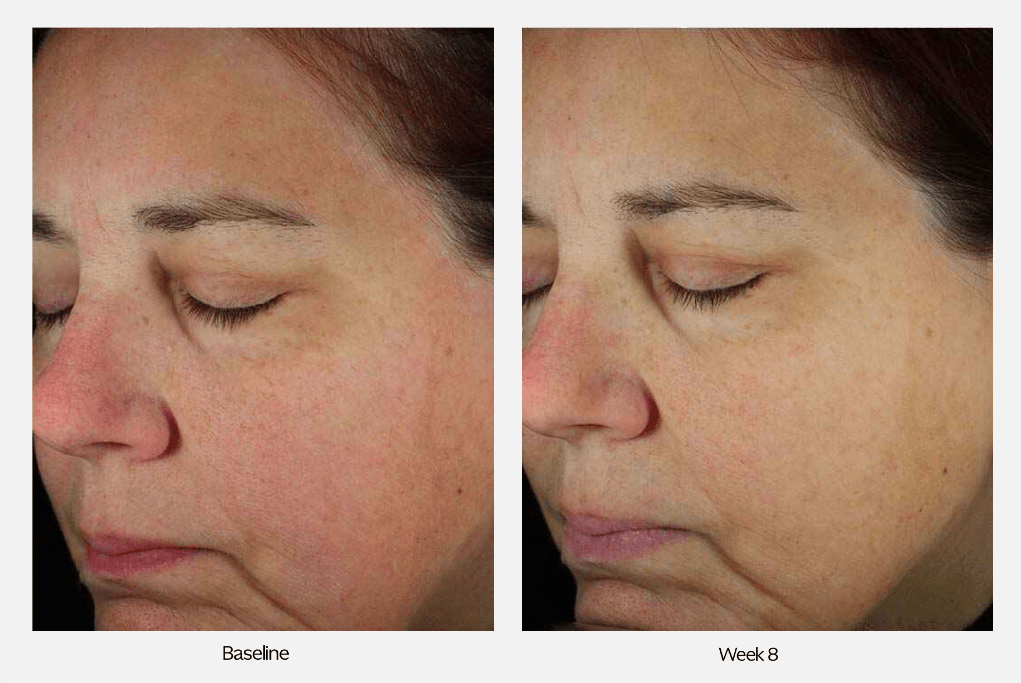 ZO Skin Health Next-Generation Daily Power Defense - Serums, Oils & Concentrates | MacroPanora